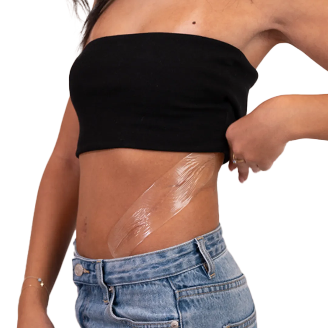 Booby Tape Silicone Scar Patches arplaster silikone